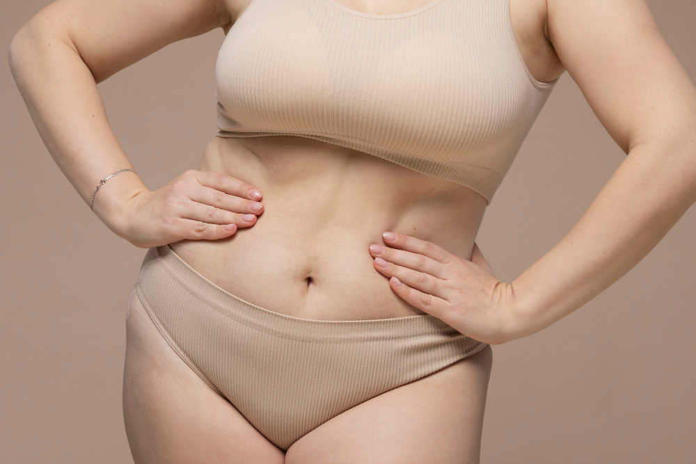 Abdominoplastia circunferencial